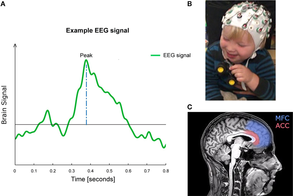 图1 - (A)这是一个脑电图大脑信号。(B)孩子戴着脑电图帽的照片。(C)如果你想象分裂的大脑分为两半,像花生一样,里面是一个一半的一部分,正如你们所看到的。前扣带皮层(ACC)和内侧额叶皮质(MFC)。这些地区的发展在十几岁的时候。图(C)改编自DrOONeil http://commons.wikimedia.org/wiki/File FMRI_Brain_Scan.jpg
