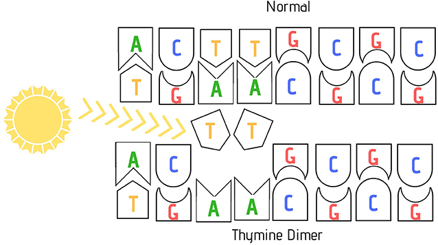 图3 -阳光中的紫外线(UV)导致胸腺嘧啶二聚体突变的形成，即同一DNA链上的两个胸腺嘧啶结合在一起，而不是正确地与相反链上的腺嘌呤结合。