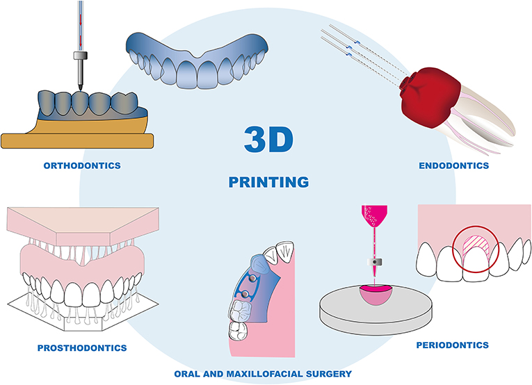 图2 - 3D打印在牙科中的应用。