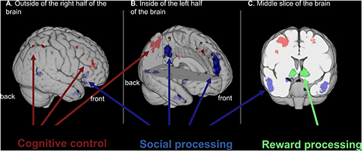 图2 -从不同角度展示了参与认知控制、社会加工和奖励加工的大脑区域。